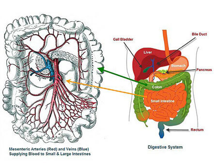 mesenteric ischemia