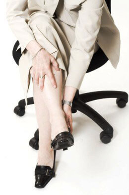 varicose vein symptoms