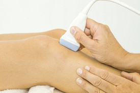 diagnosing varicose veins and ultrasound