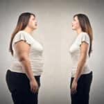 Does Obesity and Weight Affect Varicose Veins?