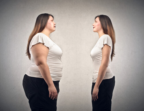 Does Obesity and Weight Affect Varicose Veins?