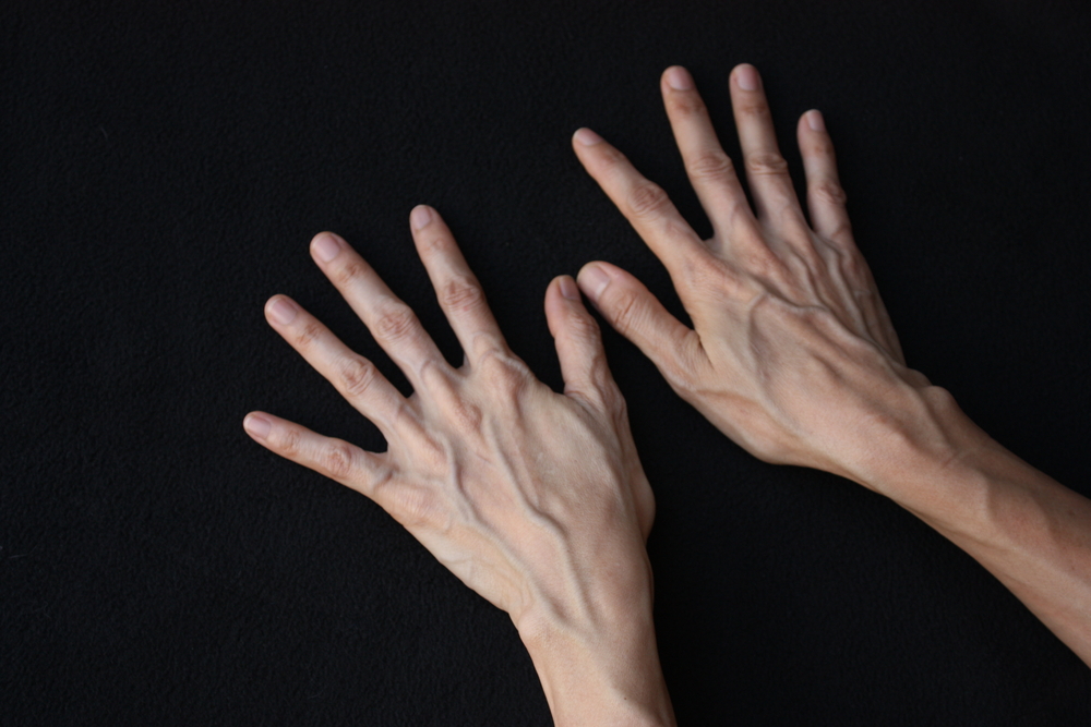 Venas visibles del brazo y de la mano